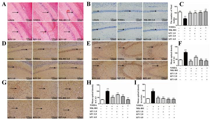 https://cdn.ncbi.nlm.nih.gov/pmc/blobs/e5fc/9785992/81fd809f49d0/ijms-23-16150-g007.jpg