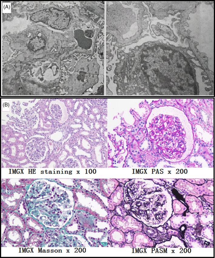 https://cdn.ncbi.nlm.nih.gov/pmc/blobs/e601/7755774/ce9507184dd3/JCLA-34-e23558-g001.jpg