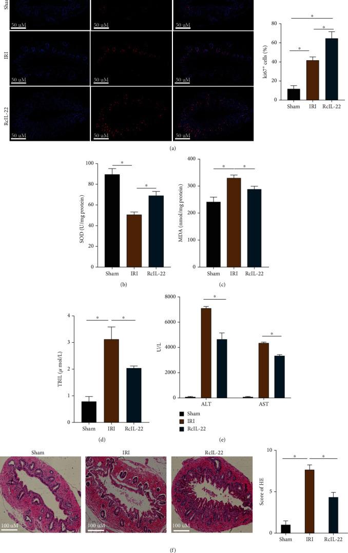 https://cdn.ncbi.nlm.nih.gov/pmc/blobs/e601/9113870/be4a92468d50/OMCL2022-9635075.009.jpg