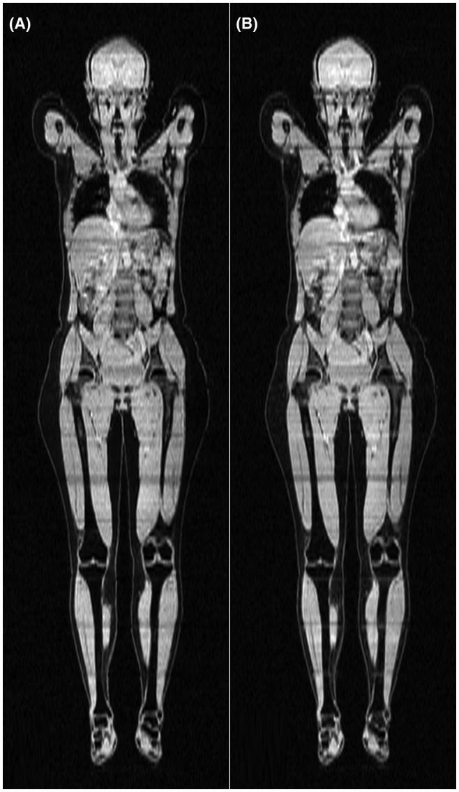 https://cdn.ncbi.nlm.nih.gov/pmc/blobs/e60c/6618066/156aa1118fc2/MRM-82-1177-g005.jpg