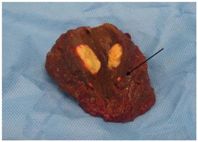 https://cdn.ncbi.nlm.nih.gov/pmc/blobs/e60e/10377919/2e6605dc7f83/cancers-15-03694-g001.jpg