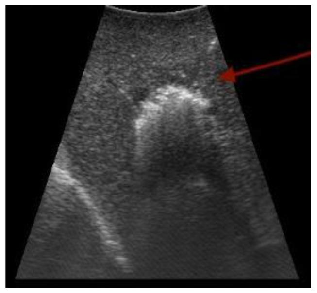 https://cdn.ncbi.nlm.nih.gov/pmc/blobs/e60e/10377919/49e4eaf143f7/cancers-15-03694-g003.jpg
