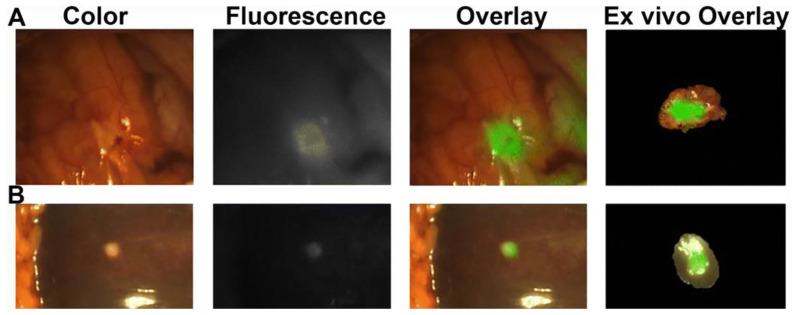 https://cdn.ncbi.nlm.nih.gov/pmc/blobs/e60e/10377919/eaa7c594a80e/cancers-15-03694-g004.jpg