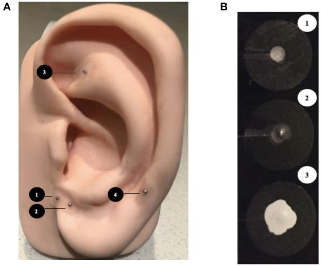https://cdn.ncbi.nlm.nih.gov/pmc/blobs/e613/7786201/05ed5f70c28c/fped-08-615008-g0001.jpg