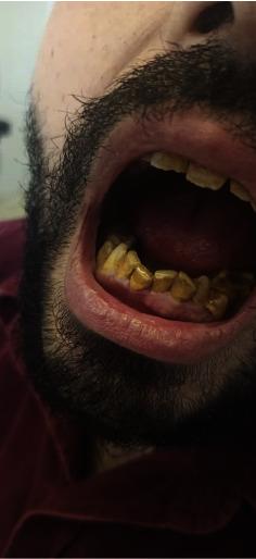 https://cdn.ncbi.nlm.nih.gov/pmc/blobs/e615/11530288/2085bf63f850/CRIDM2024-2779253.004.jpg