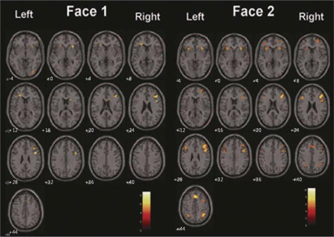 https://cdn.ncbi.nlm.nih.gov/pmc/blobs/e618/3440479/8cefd185decd/pi-9-283-g003.jpg