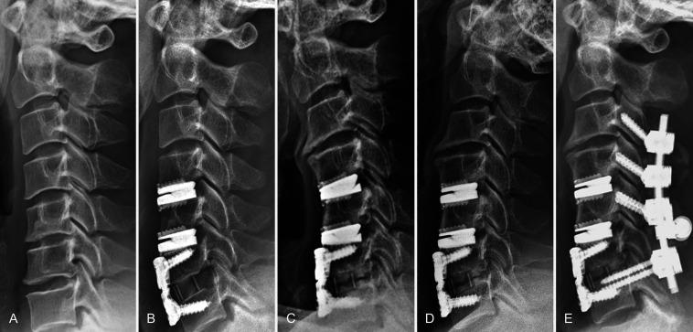 https://cdn.ncbi.nlm.nih.gov/pmc/blobs/e618/9265189/2562e43ec48d/CASE21351f1.jpg