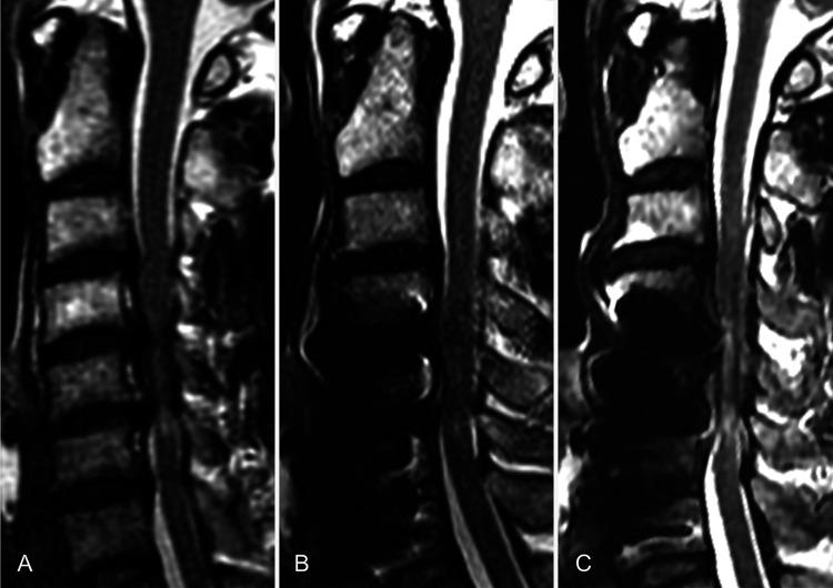 https://cdn.ncbi.nlm.nih.gov/pmc/blobs/e618/9265189/67b427186cd4/CASE21351f3.jpg