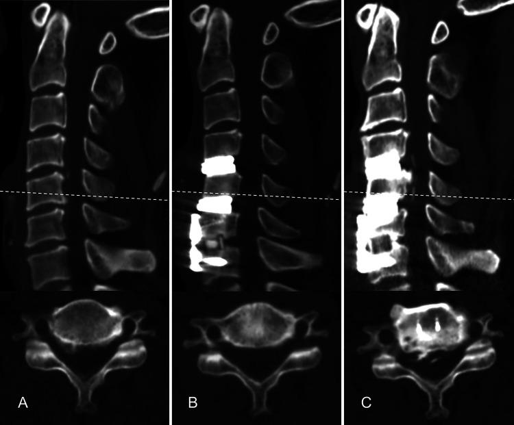 https://cdn.ncbi.nlm.nih.gov/pmc/blobs/e618/9265189/a2012879e50b/CASE21351f2.jpg
