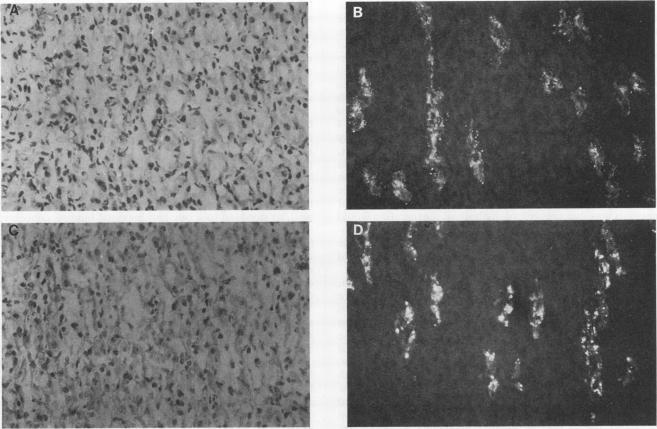 https://cdn.ncbi.nlm.nih.gov/pmc/blobs/e61f/281015/42478c3af582/iai00020-0307-a.jpg