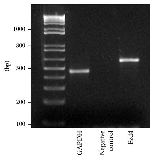 https://cdn.ncbi.nlm.nih.gov/pmc/blobs/e624/4677256/20b38a671cb3/SCI2016-9076823.004.jpg