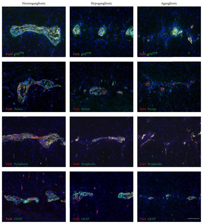 https://cdn.ncbi.nlm.nih.gov/pmc/blobs/e624/4677256/ecea2ec24198/SCI2016-9076823.008.jpg