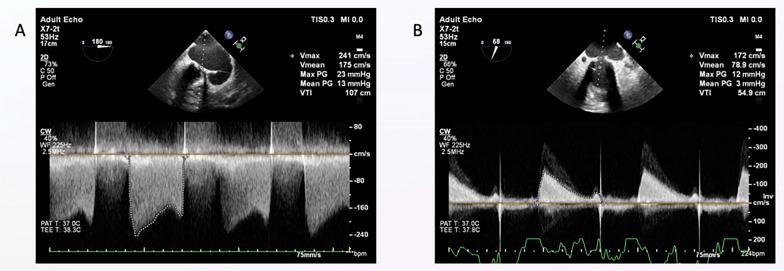 https://cdn.ncbi.nlm.nih.gov/pmc/blobs/e625/12092925/7ca0a7993aad/43044_2025_646_Fig1_HTML.jpg