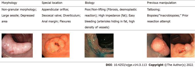 https://cdn.ncbi.nlm.nih.gov/pmc/blobs/e628/8984535/e078c9e97a7c/WJGE-14-113-g001.jpg