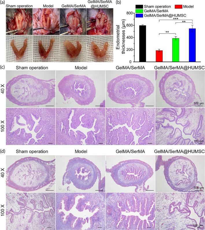 https://cdn.ncbi.nlm.nih.gov/pmc/blobs/e629/9842051/7157ab43494e/BTM2-8-e10328-g009.jpg