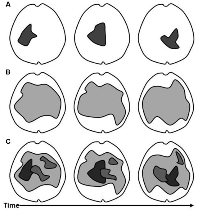 https://cdn.ncbi.nlm.nih.gov/pmc/blobs/e633/8599361/0f3caeff9391/fnhum-15-768459-g002.jpg