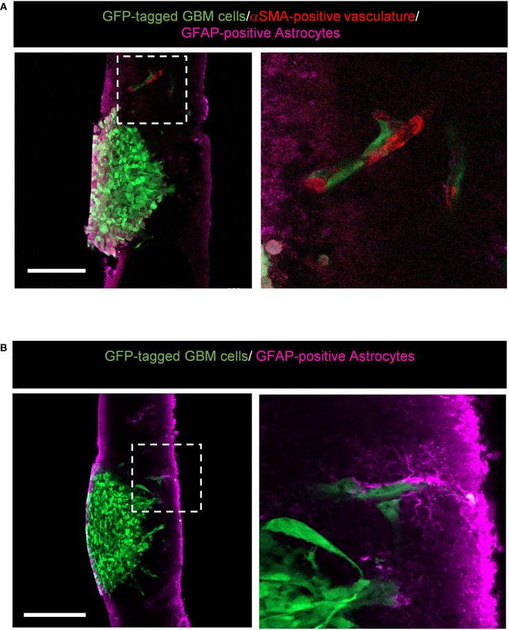 https://cdn.ncbi.nlm.nih.gov/pmc/blobs/e633/9923402/d86118b20742/fonc-13-976945-g007.jpg