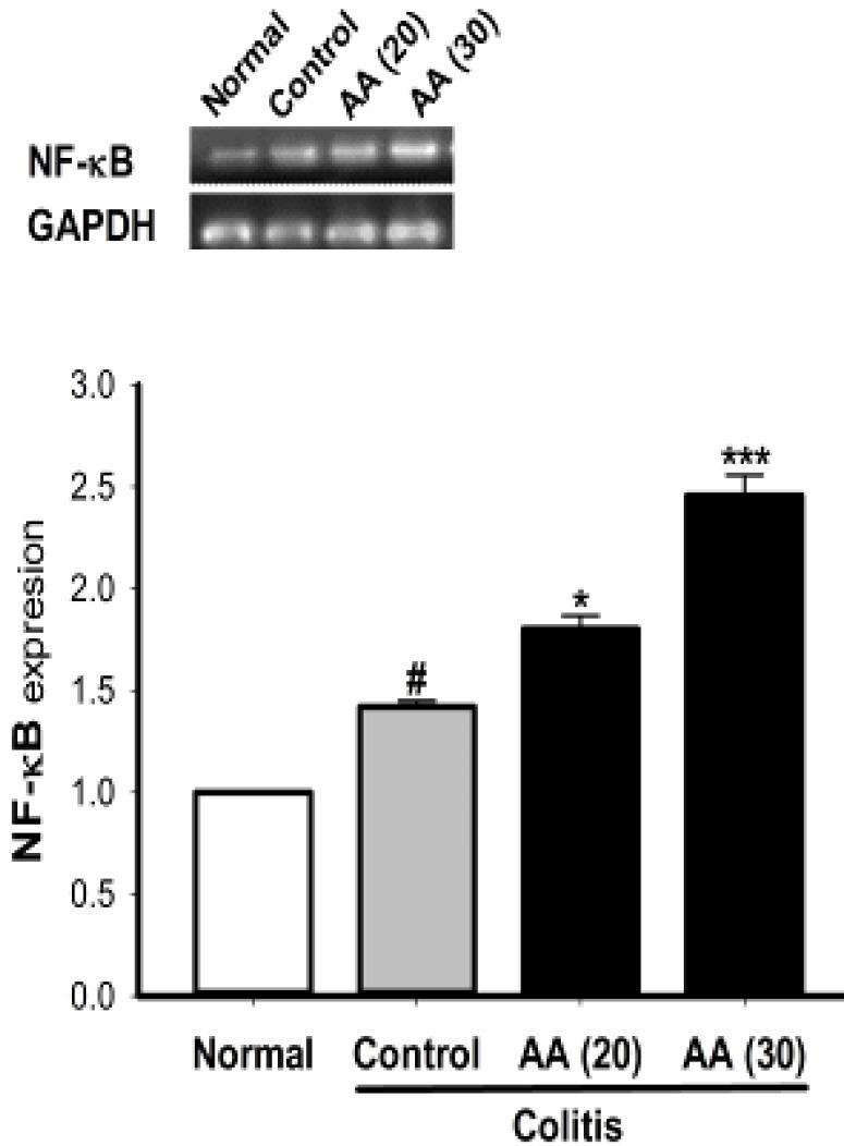 https://cdn.ncbi.nlm.nih.gov/pmc/blobs/e639/8087843/677da3831b72/IJBMS-24-312-g009.jpg
