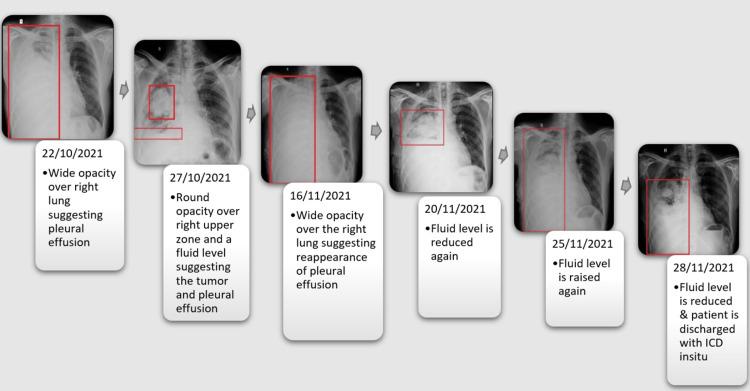 https://cdn.ncbi.nlm.nih.gov/pmc/blobs/e63b/9521302/8ff84eef594b/cureus-0014-00000028580-i02.jpg