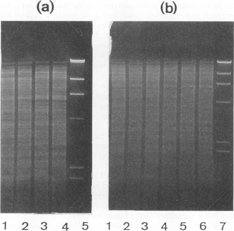 https://cdn.ncbi.nlm.nih.gov/pmc/blobs/e64a/264202/fbe643b490da/jcm00012-0063-a.jpg