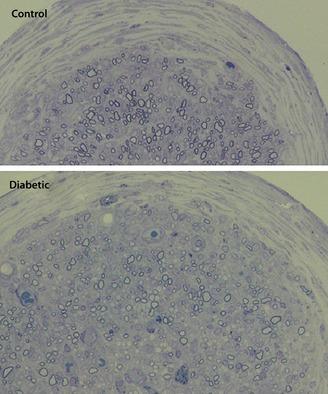 https://cdn.ncbi.nlm.nih.gov/pmc/blobs/e655/4020247/59447b58ebdc/jdi-4-533-g1.jpg
