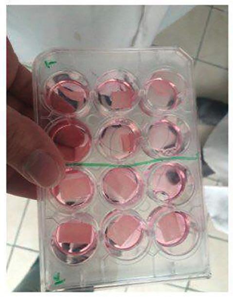 https://cdn.ncbi.nlm.nih.gov/pmc/blobs/e657/9327452/d2aef2f3444a/japid-12-84-g001.jpg