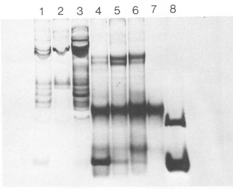 https://cdn.ncbi.nlm.nih.gov/pmc/blobs/e666/422237/249debf209ed/iai00204-0227-a.jpg