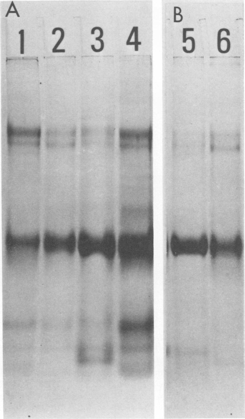 https://cdn.ncbi.nlm.nih.gov/pmc/blobs/e666/422237/c2d2c6a7d016/iai00204-0227-b.jpg