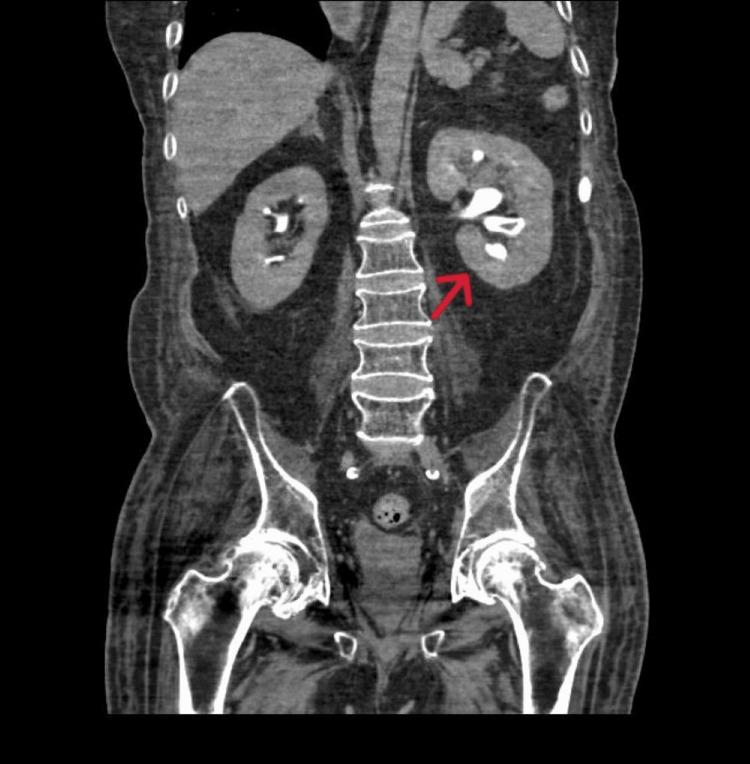 https://cdn.ncbi.nlm.nih.gov/pmc/blobs/e66a/12392043/03608982d3f4/cureus-0017-00000088907-i01.jpg