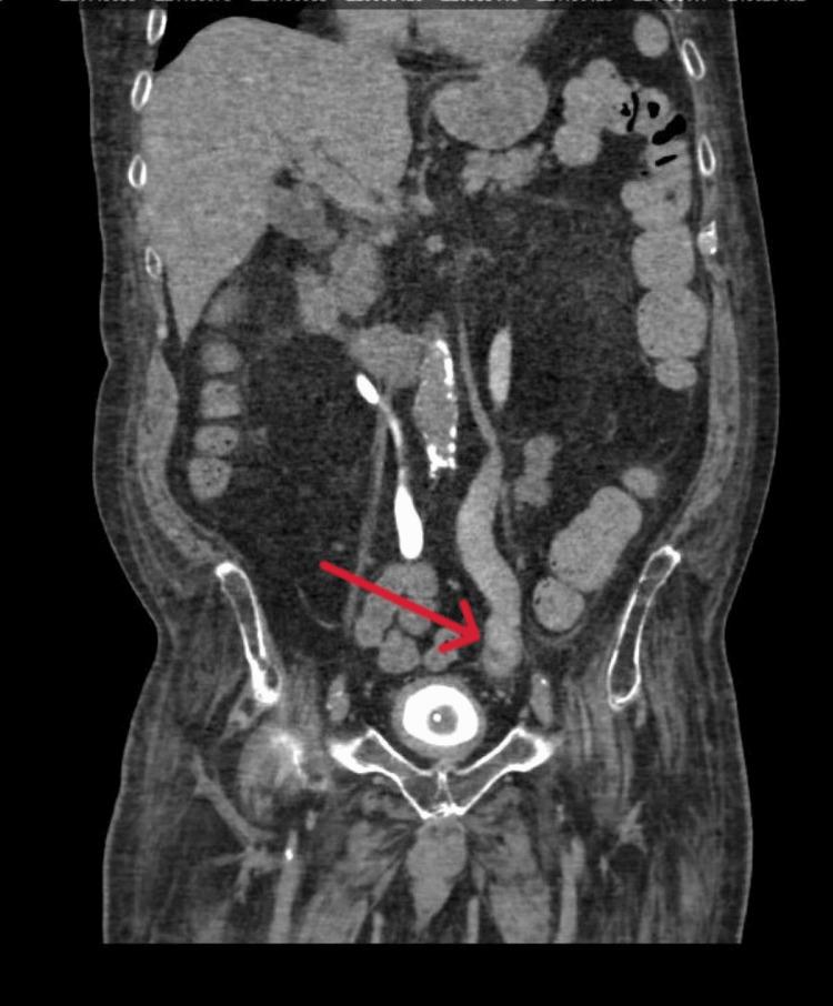 https://cdn.ncbi.nlm.nih.gov/pmc/blobs/e66a/12392043/60c2ca1108be/cureus-0017-00000088907-i02.jpg