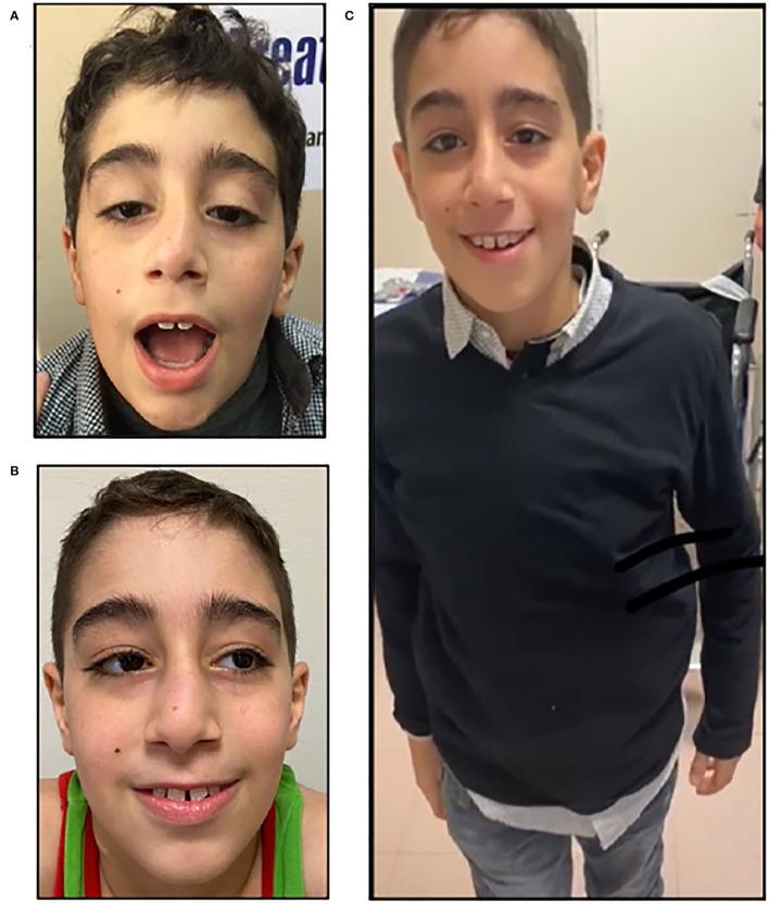 https://cdn.ncbi.nlm.nih.gov/pmc/blobs/e66b/9201482/c8f214cf1295/fneur-13-909715-g0001.jpg