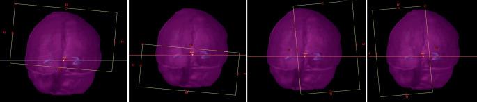 https://cdn.ncbi.nlm.nih.gov/pmc/blobs/e677/9165264/0c12677ebf11/66_2022_1916_Fig1_HTML.jpg