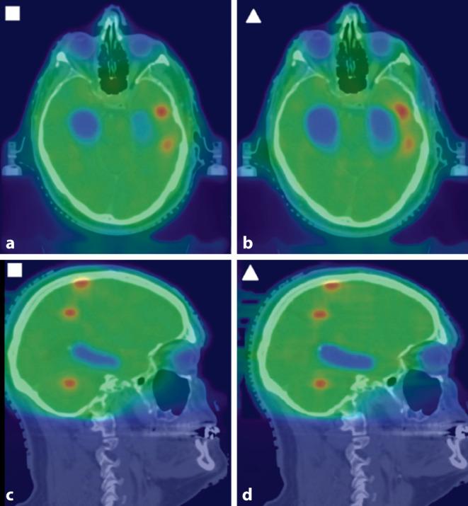 https://cdn.ncbi.nlm.nih.gov/pmc/blobs/e677/9165264/81f1604fc8df/66_2022_1916_Fig3_HTML.jpg