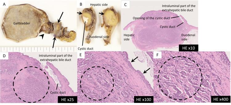 https://cdn.ncbi.nlm.nih.gov/pmc/blobs/e67f/11670260/f983c25f0c04/cureus-0016-00000074486-i05.jpg