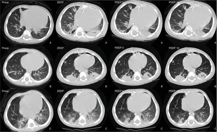 https://cdn.ncbi.nlm.nih.gov/pmc/blobs/e680/12143648/50430281cca7/gr1.jpg