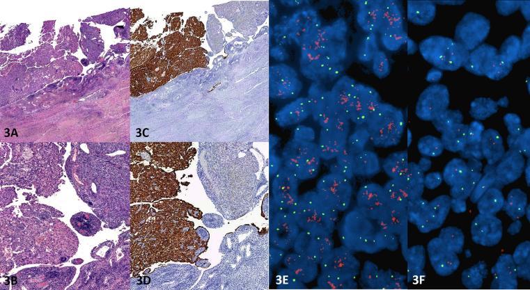 https://cdn.ncbi.nlm.nih.gov/pmc/blobs/e689/7103767/3eddf16ddbd5/gr3.jpg