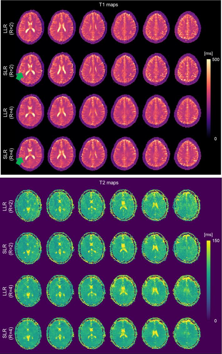 https://cdn.ncbi.nlm.nih.gov/pmc/blobs/e691/12021333/0dd1271abd9f/MRM-94-119-g006.jpg