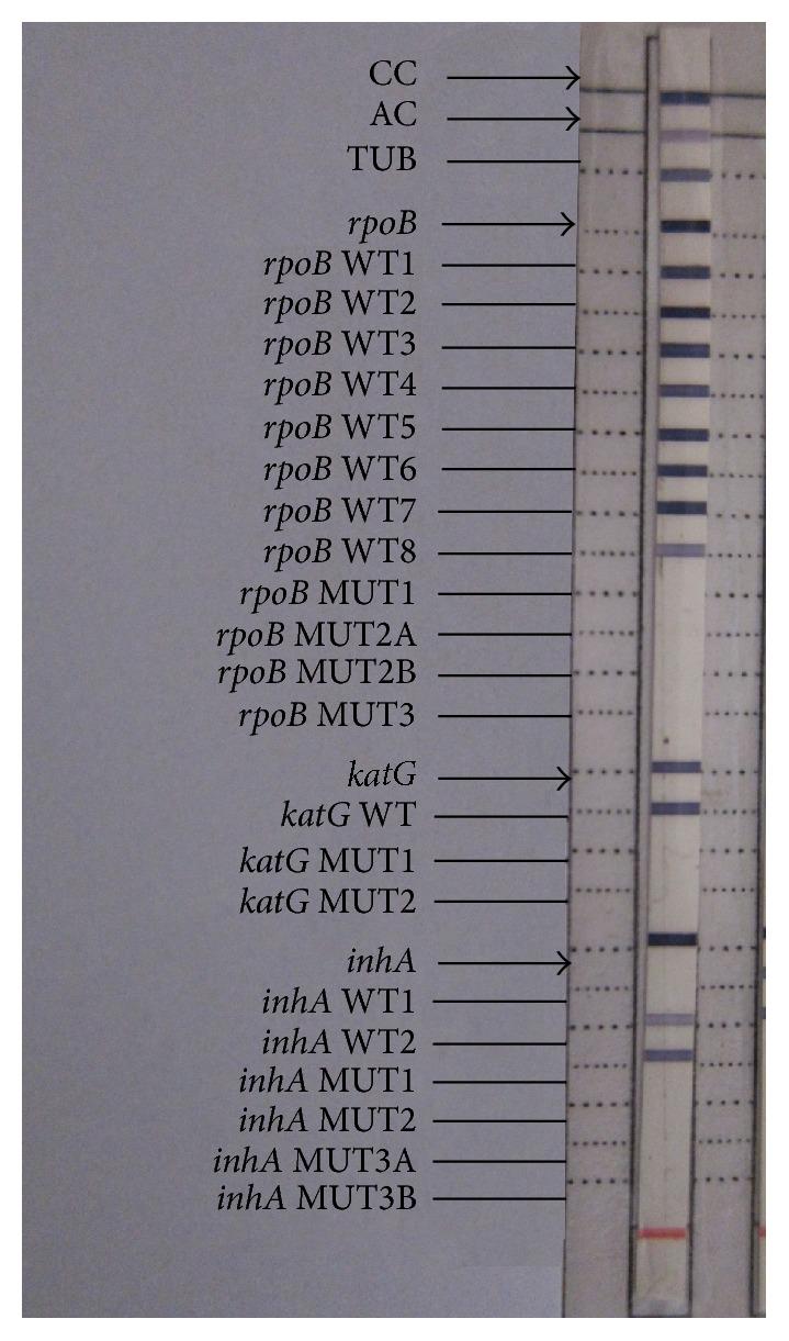 https://cdn.ncbi.nlm.nih.gov/pmc/blobs/e691/4821965/ffceacffd32e/JPATH2016-6235618.005.jpg