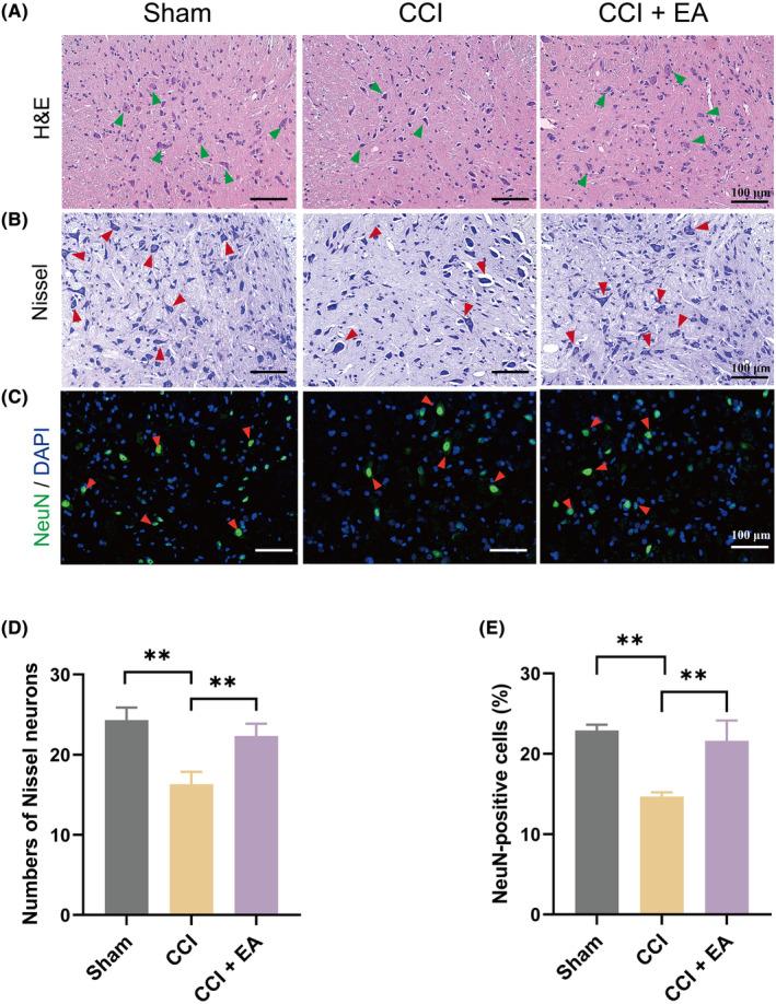 https://cdn.ncbi.nlm.nih.gov/pmc/blobs/e693/10955159/88d89d91aa59/JCMM-28-e18240-g002.jpg