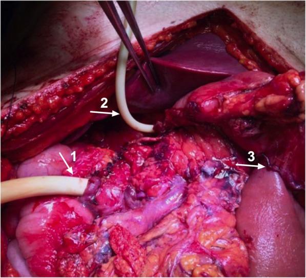 https://cdn.ncbi.nlm.nih.gov/pmc/blobs/e694/7216496/6c6c222585c5/12893_2020_763_Fig3_HTML.jpg