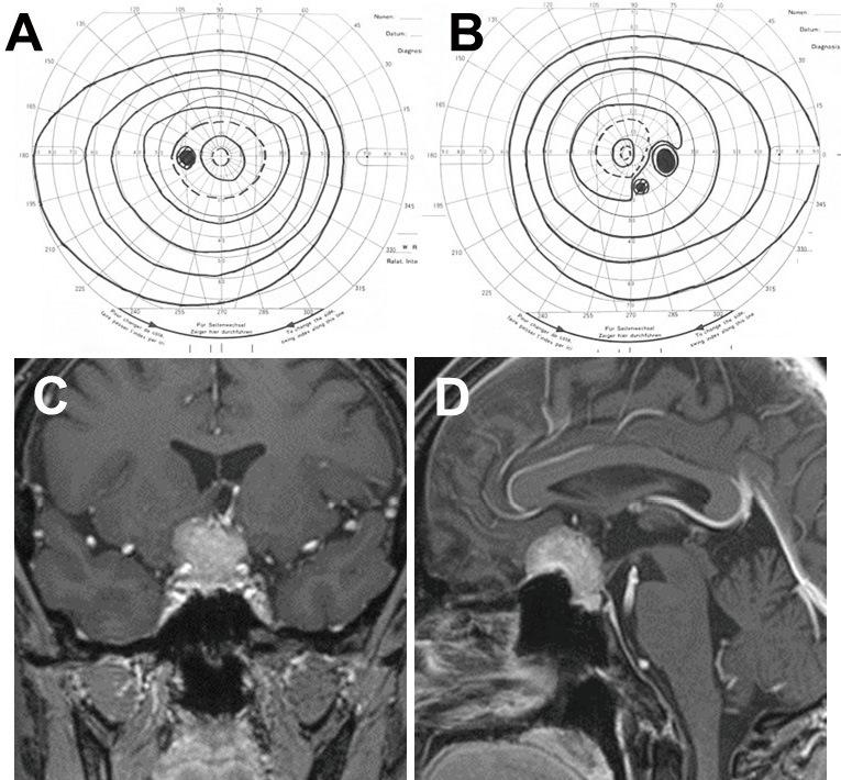 https://cdn.ncbi.nlm.nih.gov/pmc/blobs/e696/10917652/0844013c6cd8/2188-4226-11-0055-g001.jpg