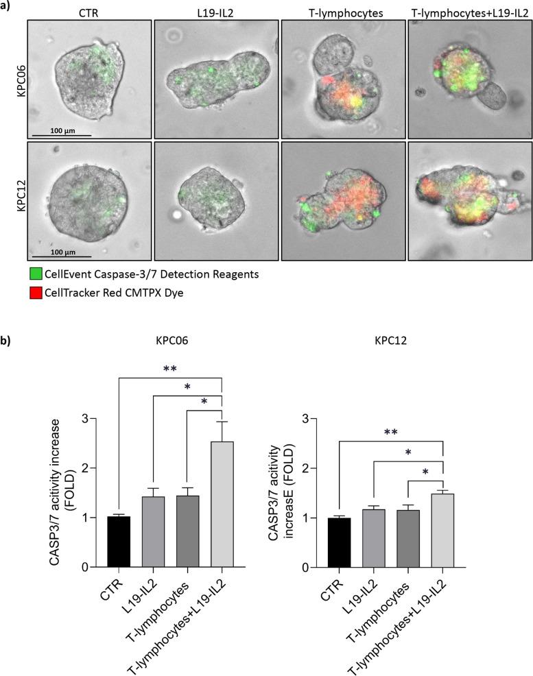 https://cdn.ncbi.nlm.nih.gov/pmc/blobs/e6a7/11705946/c9a401fe3e8e/13046_2024_3238_Fig2_HTML.jpg