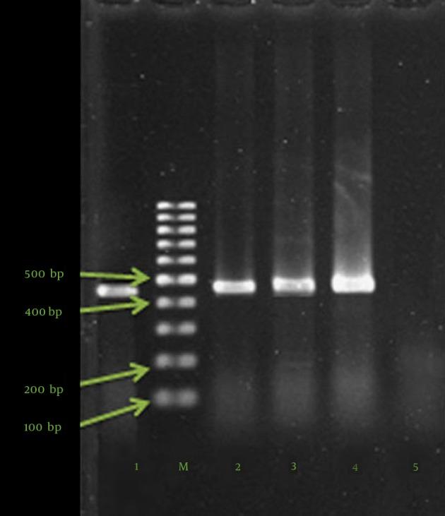 https://cdn.ncbi.nlm.nih.gov/pmc/blobs/e6a7/4609387/503892518381/jjm-08-09-22582-g001.jpg
