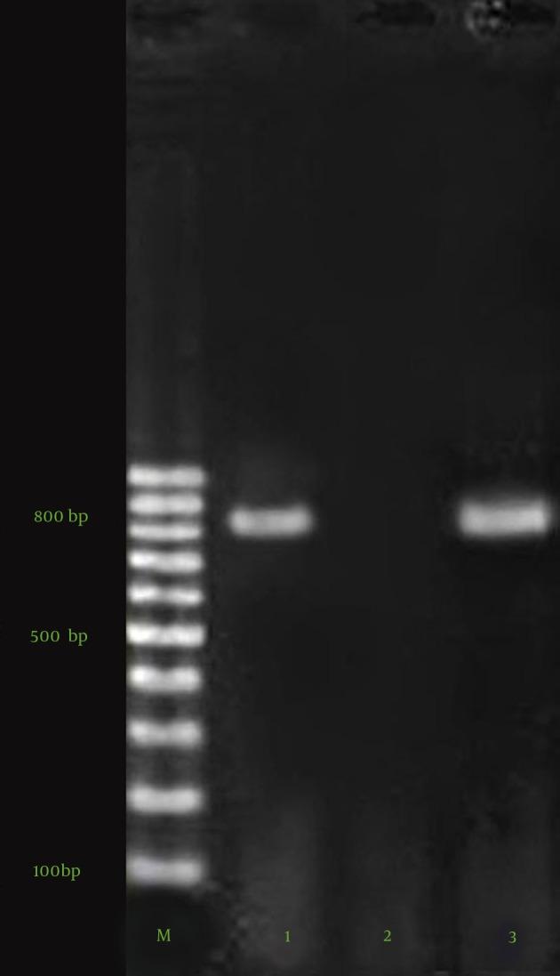 https://cdn.ncbi.nlm.nih.gov/pmc/blobs/e6a7/4609387/af6c1a31b88b/jjm-08-09-22582-g002.jpg