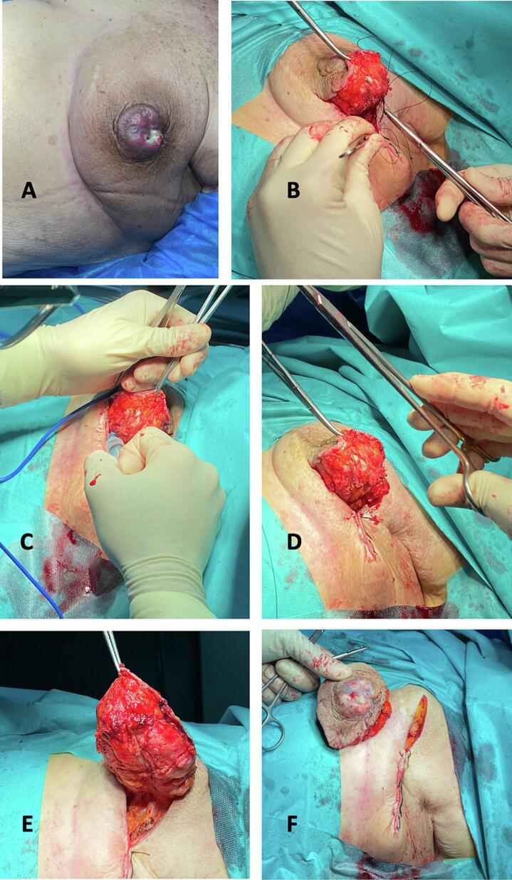 https://cdn.ncbi.nlm.nih.gov/pmc/blobs/e6aa/10550772/c7cdded97e96/gr2.jpg