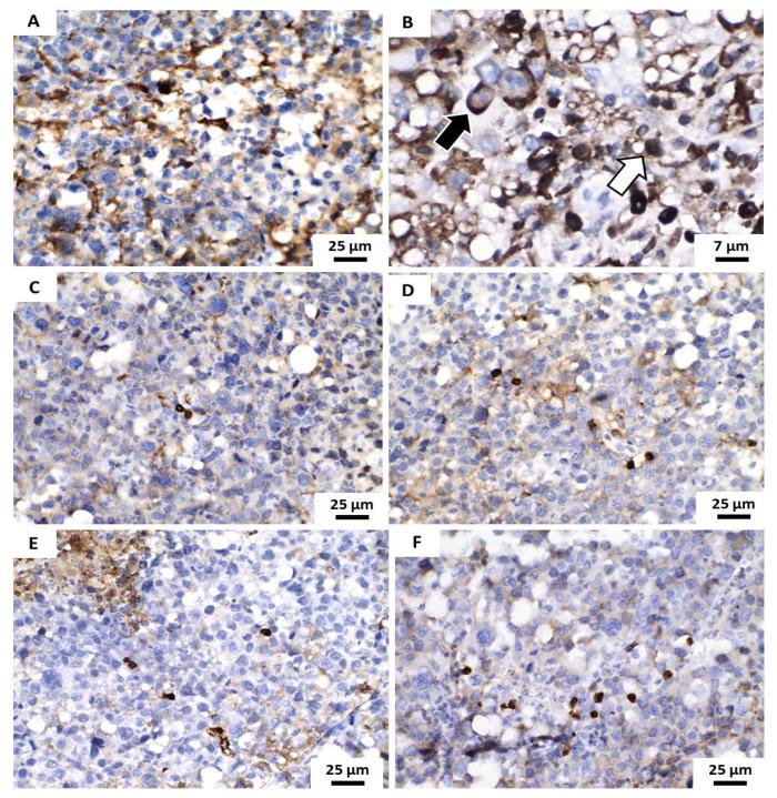 https://cdn.ncbi.nlm.nih.gov/pmc/blobs/e6b8/7916601/0b11d18f6990/pharmaceutics-13-00245-g009.jpg