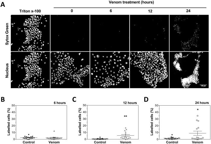 https://cdn.ncbi.nlm.nih.gov/pmc/blobs/e6b9/5919693/fcace2b86e07/pntd.0006427.g005.jpg