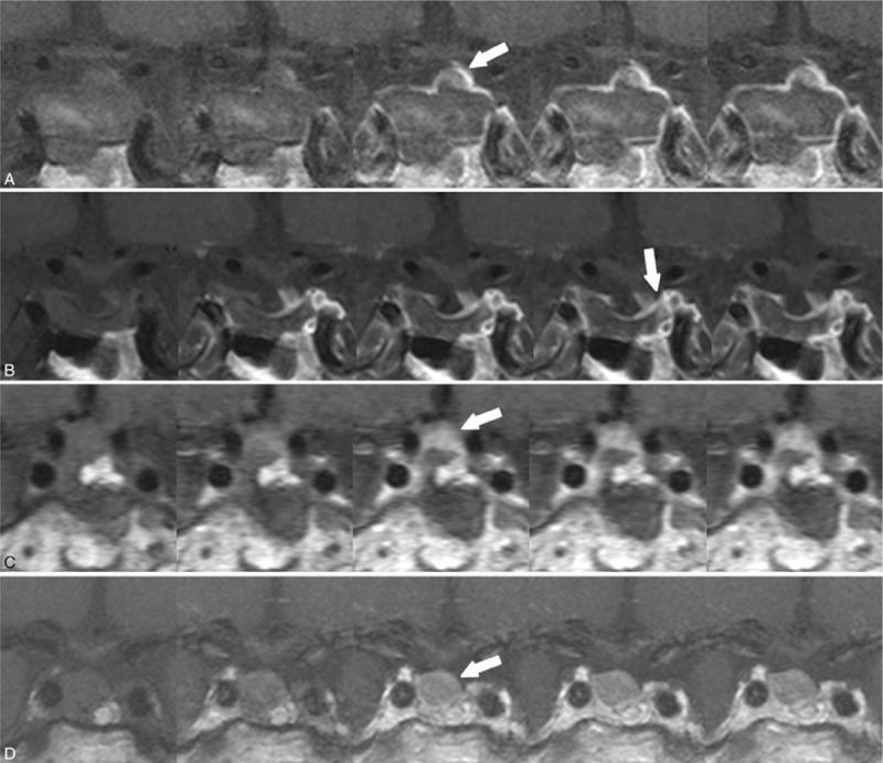 https://cdn.ncbi.nlm.nih.gov/pmc/blobs/e6be/6635295/6de86a804fb6/medi-98-e16089-g005.jpg