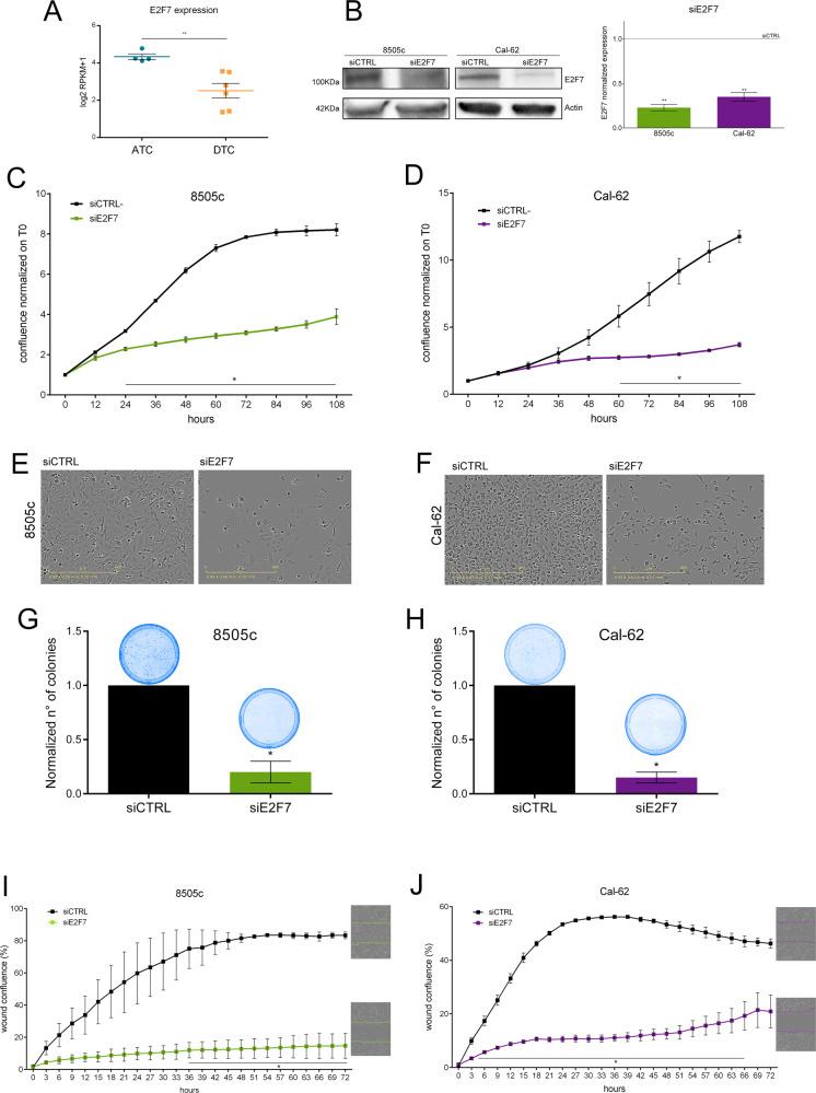 https://cdn.ncbi.nlm.nih.gov/pmc/blobs/e6c0/9918458/bf8823802da8/41419_2023_5603_Fig3_HTML.jpg