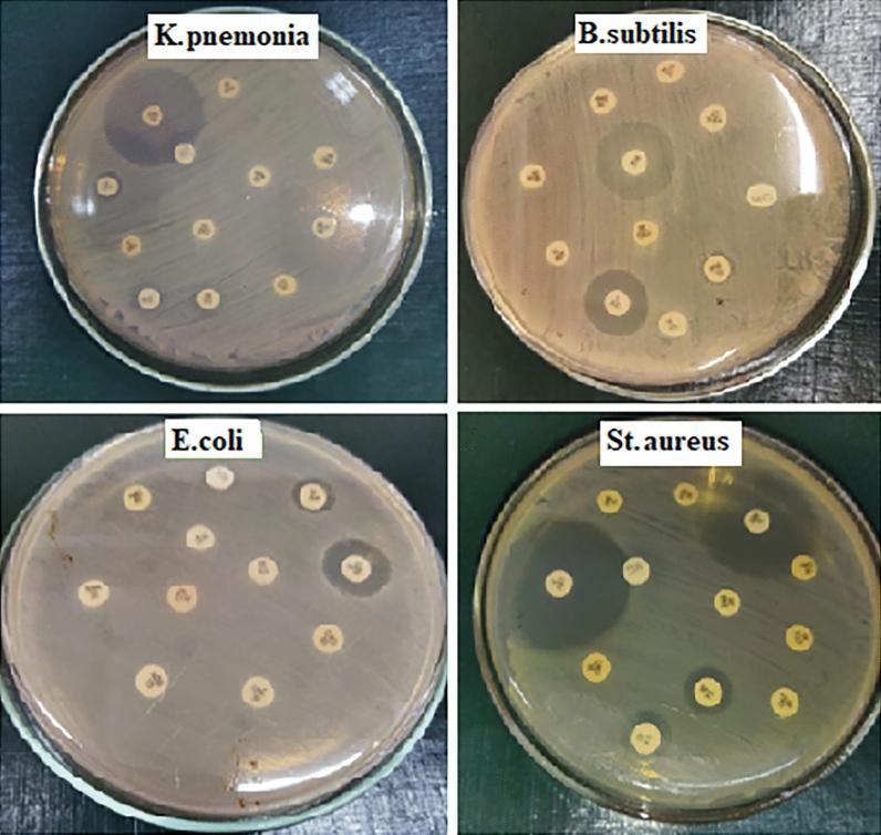 https://cdn.ncbi.nlm.nih.gov/pmc/blobs/e6c8/10624884/4d93fcb71b28/41598_2023_46287_Fig4_HTML.jpg